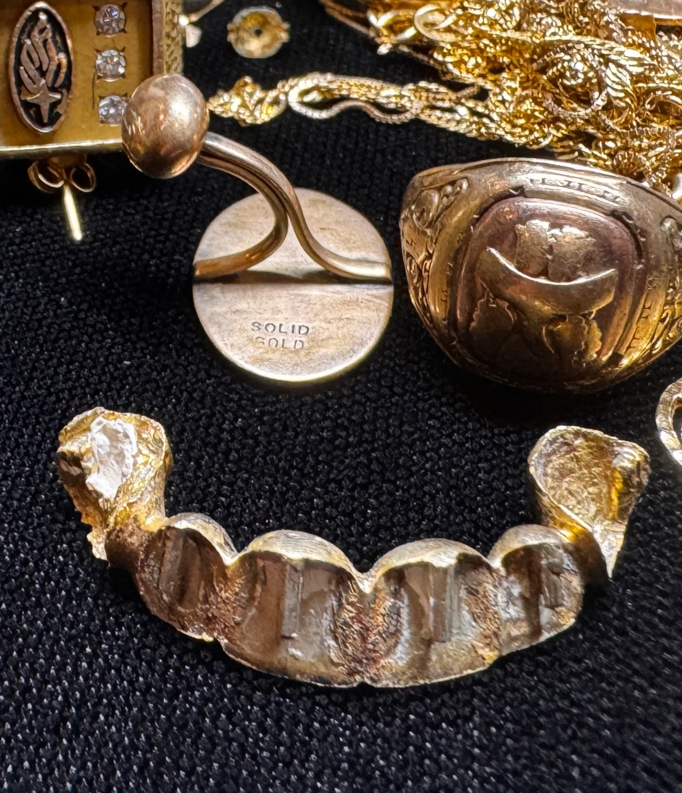 gold dental grill with cufflink and ring on black surface